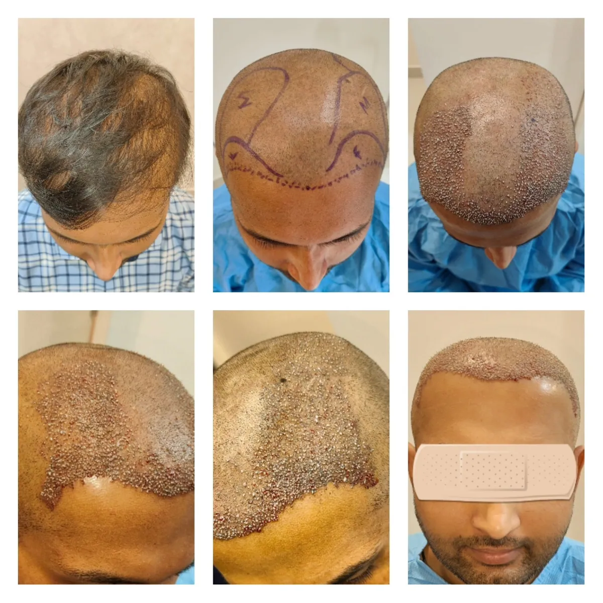 Krity 360: Elevating Aesthetic Excellence Through Surgeon-Led Innovation in Bengaluru